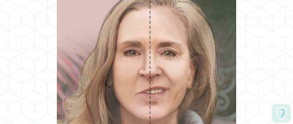 Диагноз: неврит правого лицевого нерва
