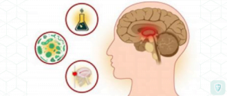 Гриппозный токсический диэнцефалит