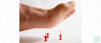 Гриппозный токсический полиневрит