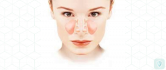 Лечение гайморита без пробивания