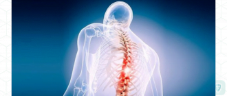 Миелит, спинальный арахноидит