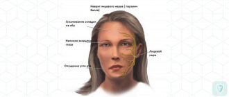 Лицевой нерв простуда