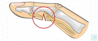 Поражения периферической нервной системы