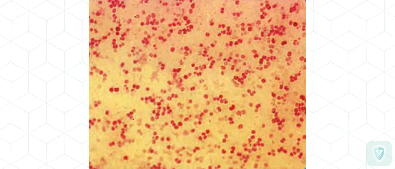 Возможность развития при гриппе энцефалитов и менингоэнцефалитов