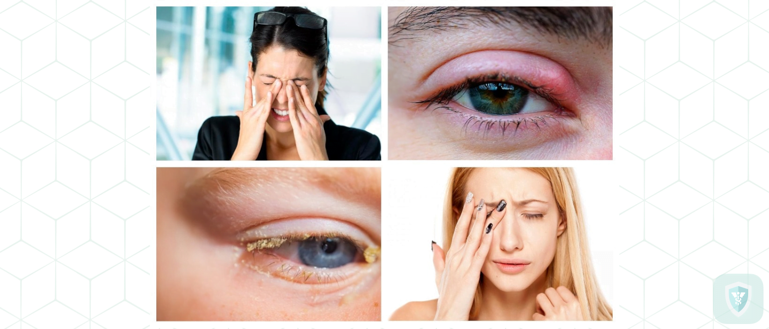 Лечение демодекоза глаз