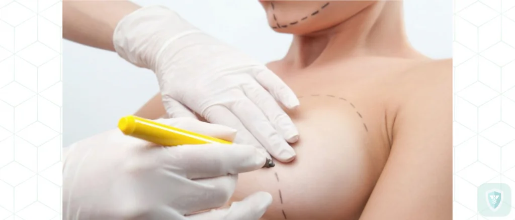 История операций по увеличению груди