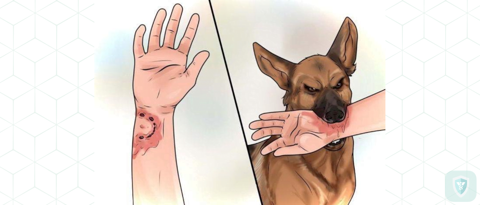 Что делать, если укусила собака