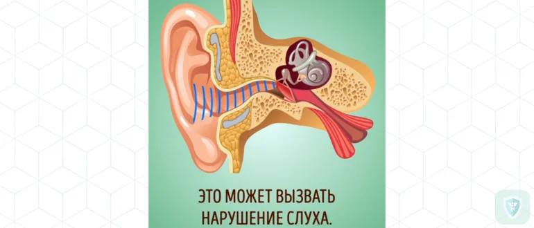 Почему нельзя пользоваться ватными палочками?